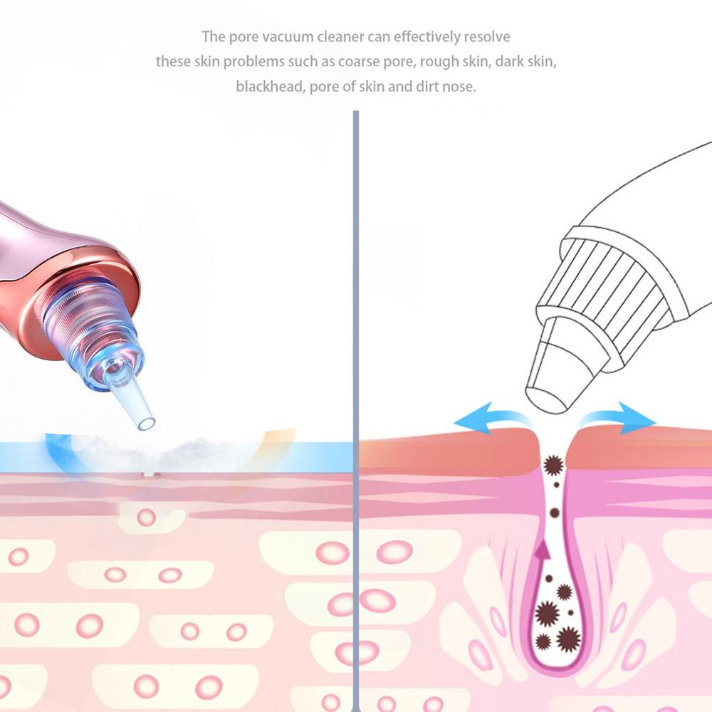 Removedor de Cravos (Frete Grátis)