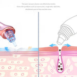 Removedor de Cravos (Frete Grátis)